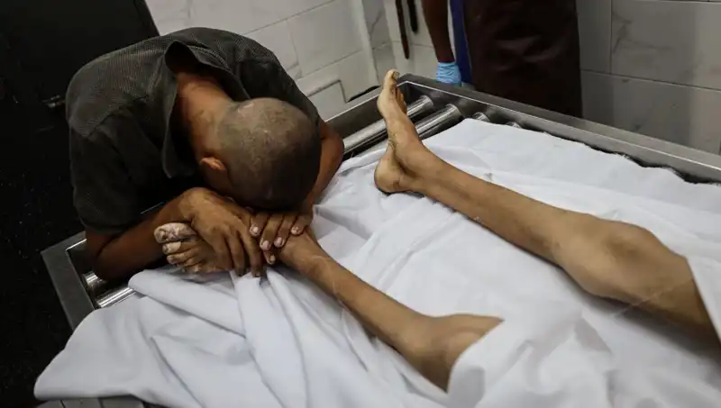 Gazze'de Bir Çocuk Daha Açlıktan Hayatını Kaybetti: Acı Gerçekler Ortaya Çıktı