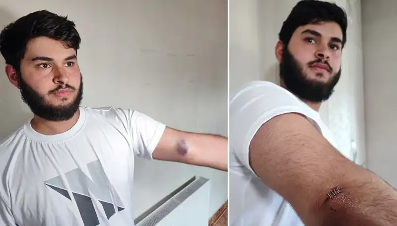 Bahçeye Kaçan Top, Mahallede Kaos Çıkardı: Konuya Dair Tüm Ayrıntılar